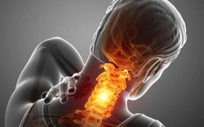 Αυχενικό Σύνδρομο